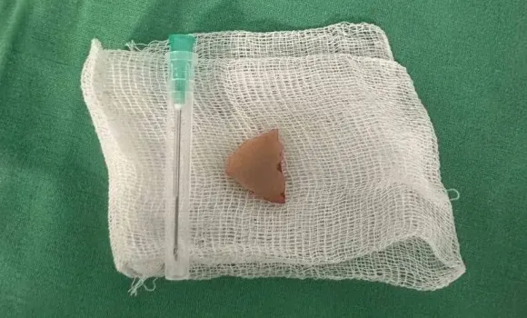 В Казани праздничный ужин едва не закончился трагедией из-за кости барана