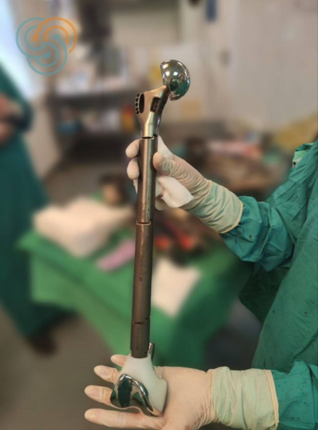 В Татарстане успешно провели уникальную операцию по замене бедренной кости