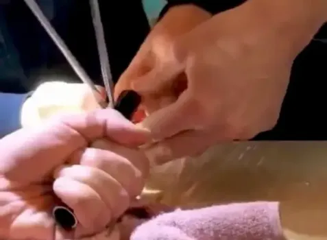 В Казани спасатели освободили палец мальчика из ножки стула