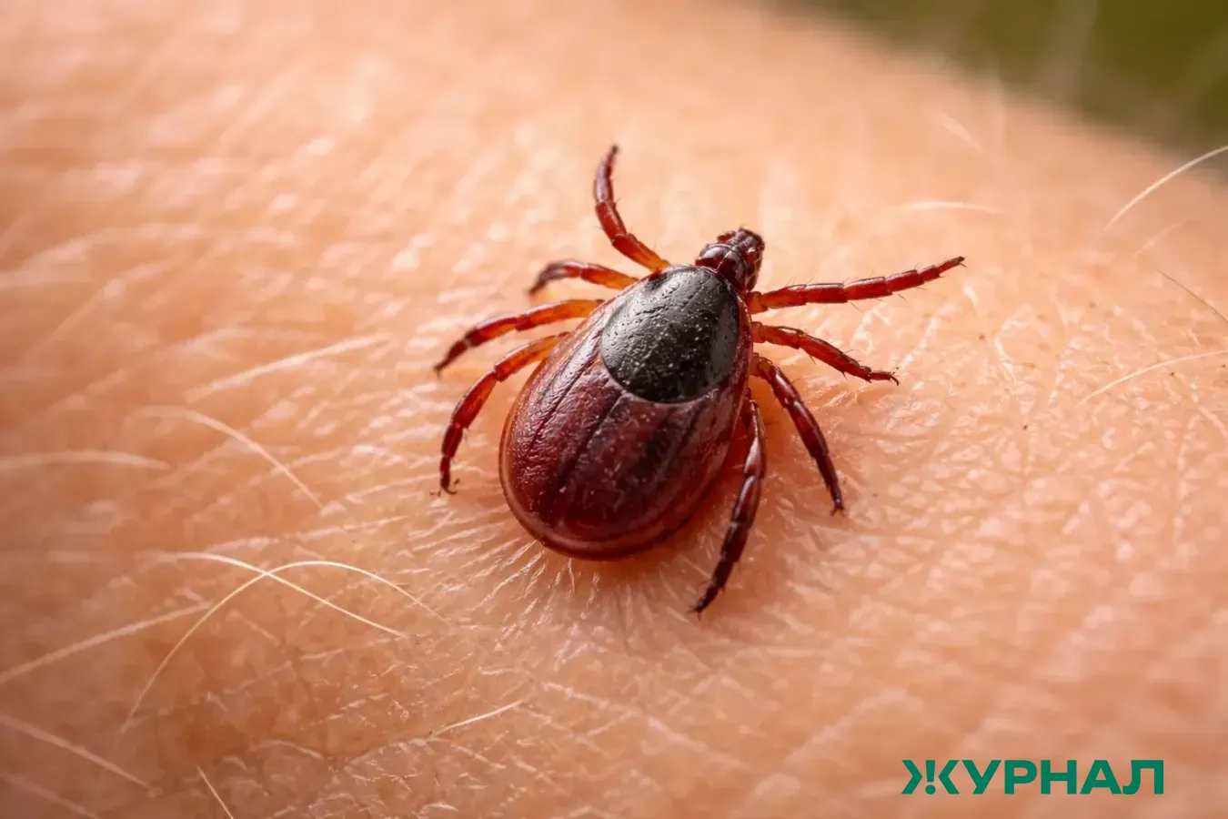 В Елабужском районе 4-летний мальчик пострадал от укуса клеща